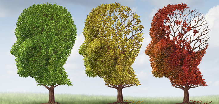 Alzheimers-Women_BrainConcept.jpg